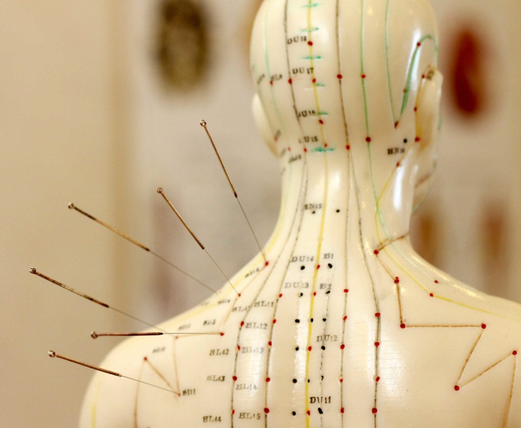 Acupuncture chart